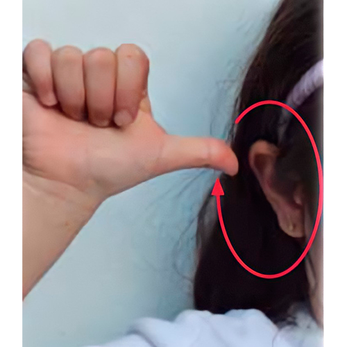 Se hace una letra a, y se mueve en círculo
                        alrededor de la oreja.